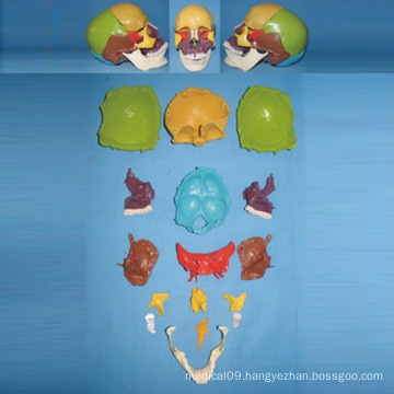 Natural Size Human Skull Dispersive Bone Skeleton Model (R050130)